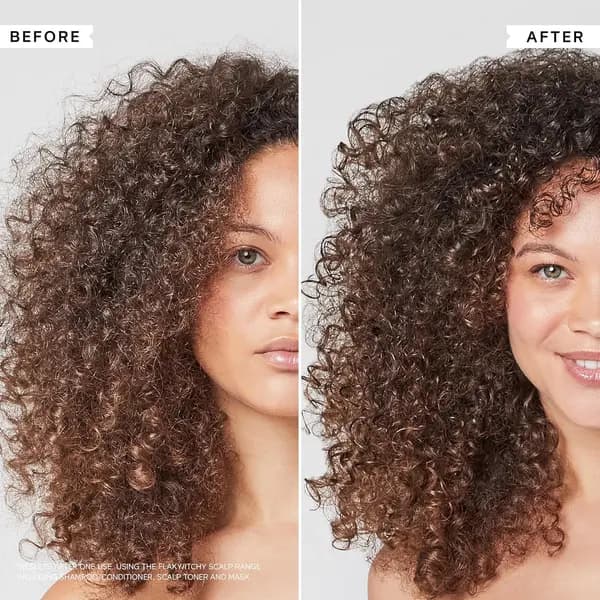 Produktbild von Flaky Scalp Cleansing Shampoo